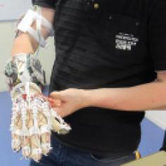 Le dernier prototype du gant bionique construit par les étudiants de l’ISEN. © Vincent Morel.